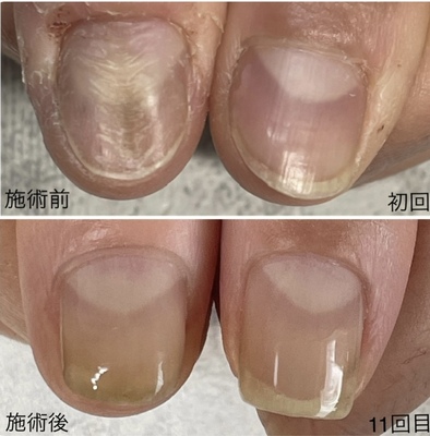 ご予約はこちらをタップ