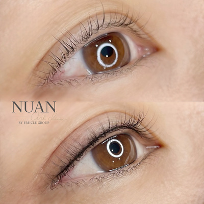 NUAN art clinic【ご予約】