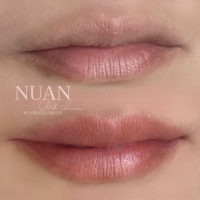 NUAN art clinic【ご予約】