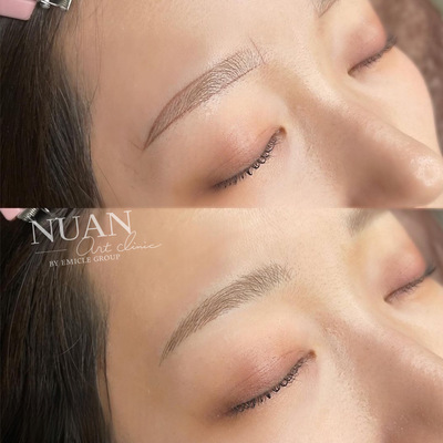 NUAN art clinic【ご予約】