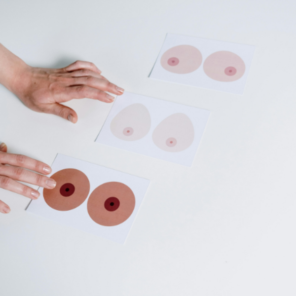 乳がん術後アートメイク