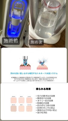 フェイシャルエステ