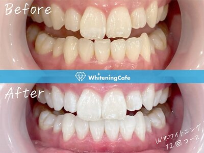 ホワイトニングカフェ　仙台店