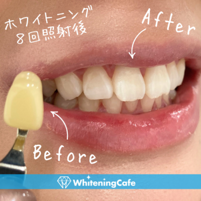 ホワイトニングカフェ秋葉原店