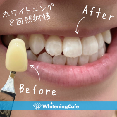 ホワイトニングカフェ秋葉原店