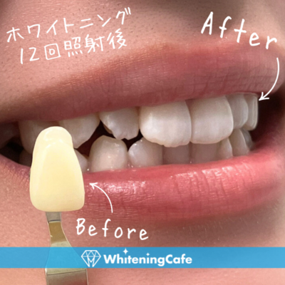 ホワイトニングカフェ秋葉原店