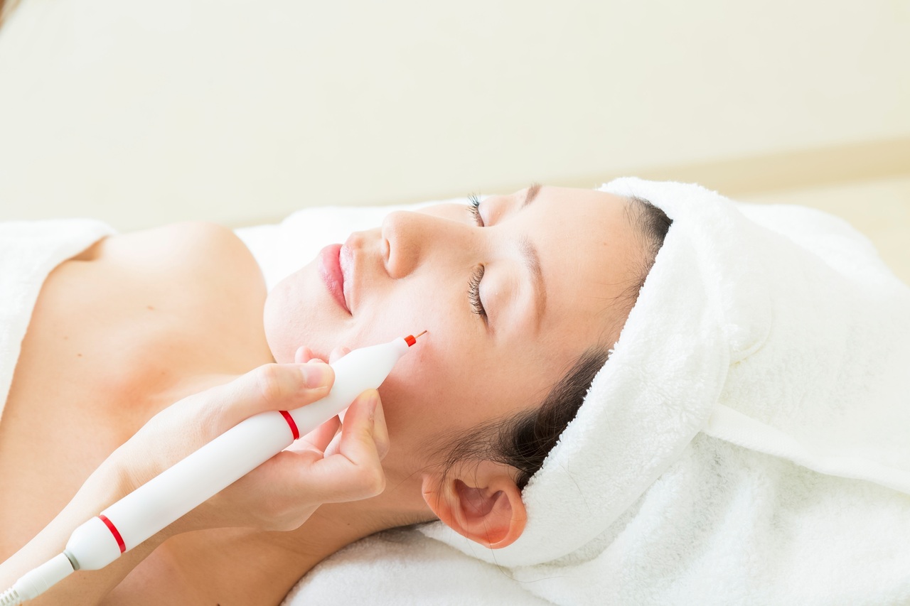 シミ・そばかすケア　予約はこちらから！