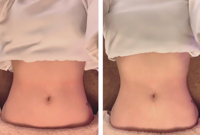 はいふんメニュー