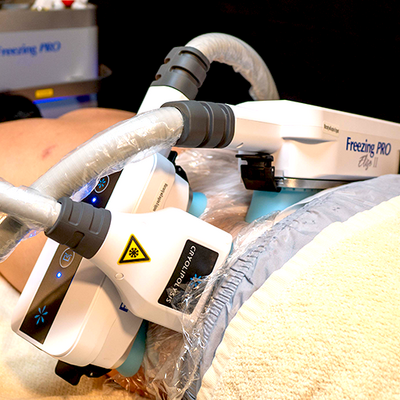 【男性】🏄‍♂️Cool Lobo MEN・脂肪冷却メニュー