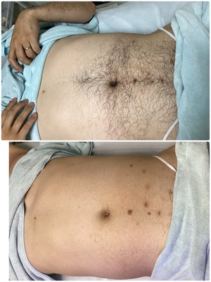 脱毛サロンきらり　予約ページ