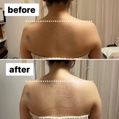 ▶︎▶︎デトックスリンパケア