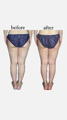 ▶︎▶︎デトックスリンパケア