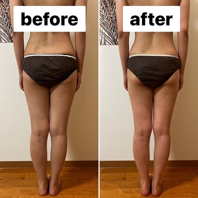 ▶︎▶︎デトックスリンパケア