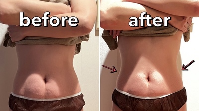 ▶︎▶︎デトックスリンパケア