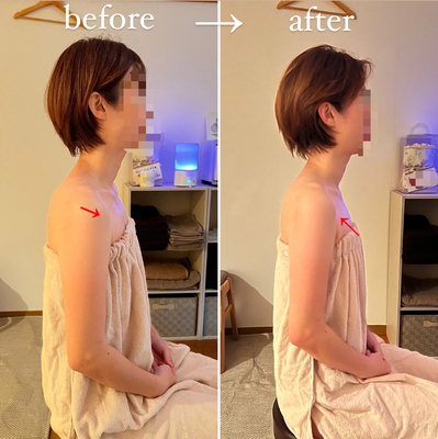 ▶︎▶︎デトックスリンパケア