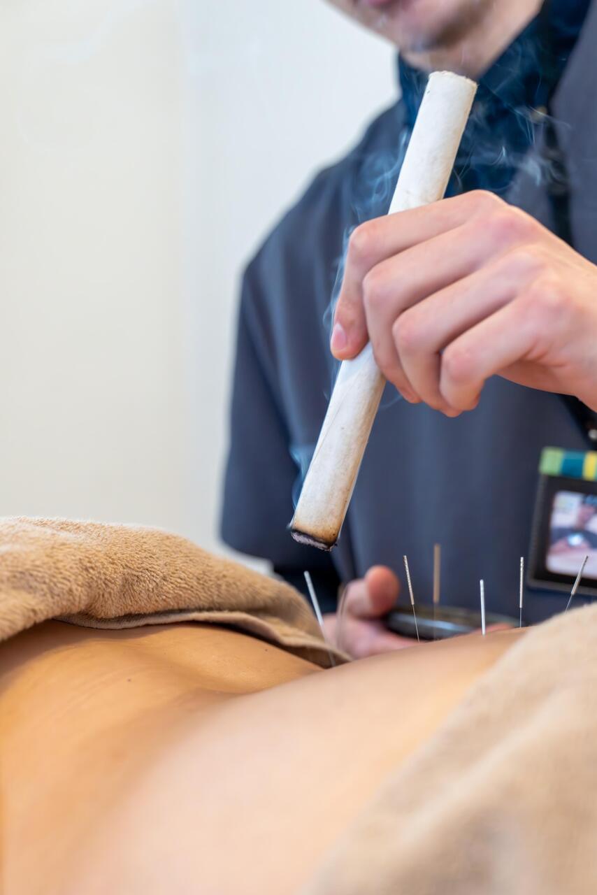 滝川店 全身鍼灸施術