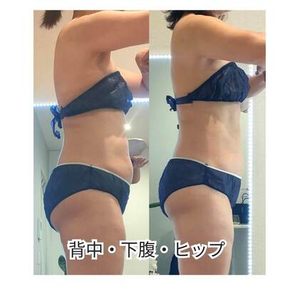 迷ったらこれ【お悩み別全身美容整体】