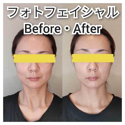 迷ったらこれ【お悩み別全身美容整体】