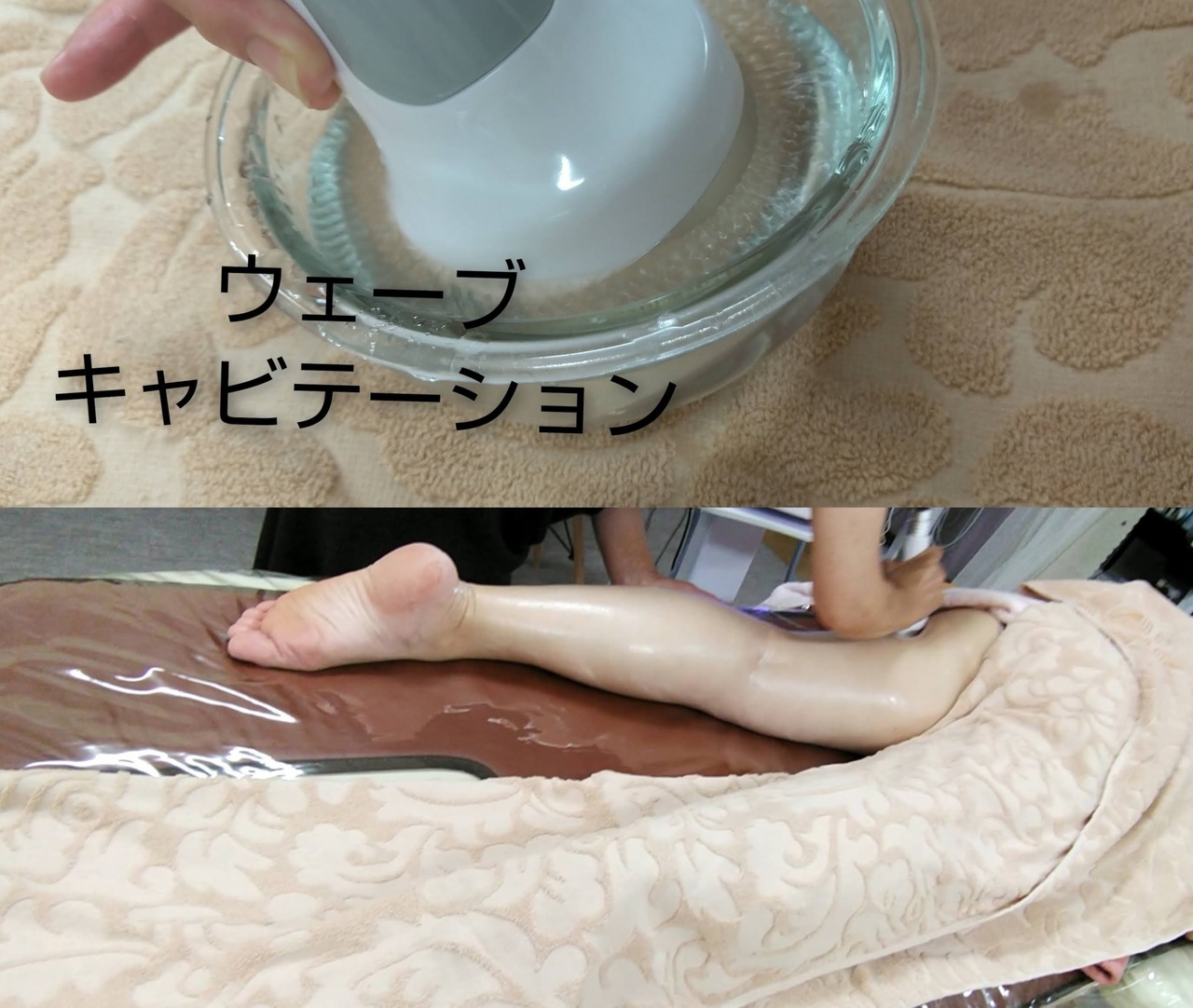 痩身キャビ ラジオ波70分¥6.500(都度払¥6.000)