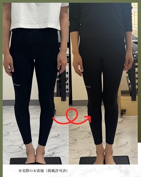 LINA限定    O脚改善90Days Program