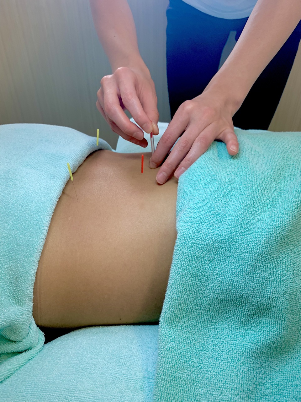 鍼治療のコース