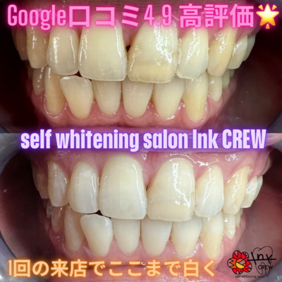 セルフホワイトニングサロン　lnk.CREW 予約はこちらからになります✨