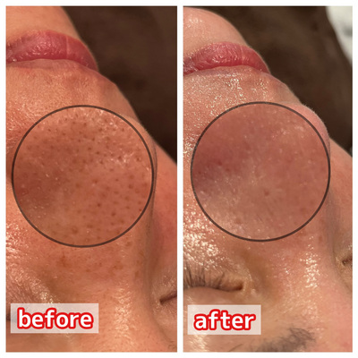 エステサロンzinの予約メニューはこちら