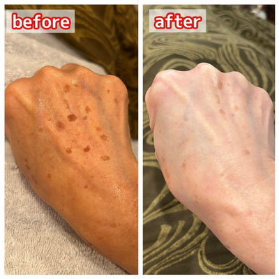 エステサロンzinの予約メニューはこちら