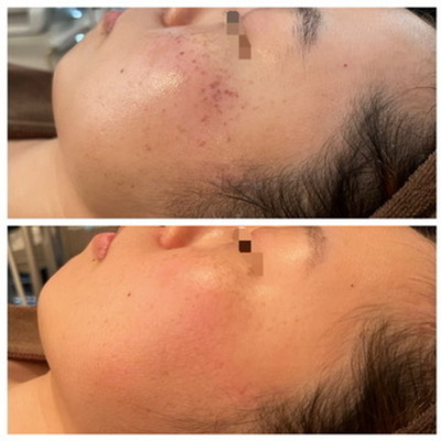 エステサロンzinの予約メニューはこちら