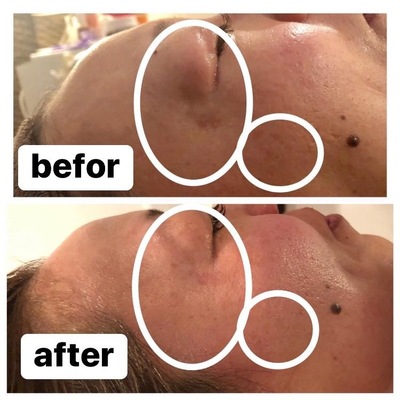 エステサロンzinの予約メニューはこちら