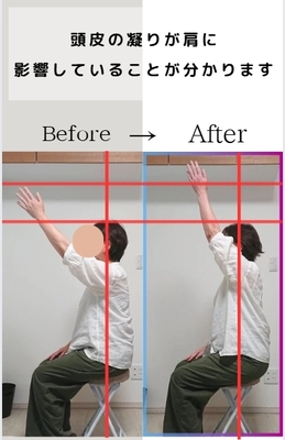 自律神経を整えるヘッドスパ　メニュー