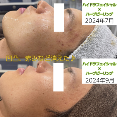 脱毛・フェイシャル・瘦身エステのご予約はこちら