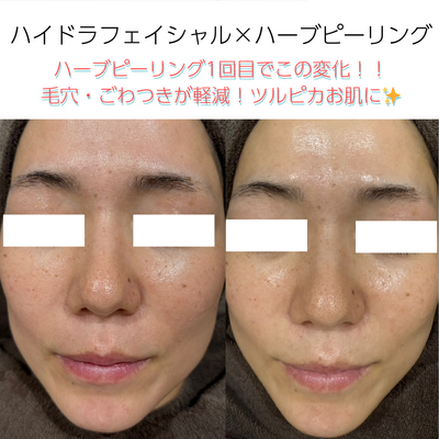 脱毛・フェイシャル・瘦身エステのご予約はこちら