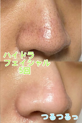 脱毛・フェイシャル・瘦身エステのご予約はこちら