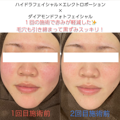 脱毛・フェイシャル・瘦身エステのご予約はこちら