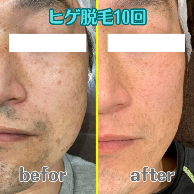 脱毛・フェイシャル・瘦身エステのご予約はこちら