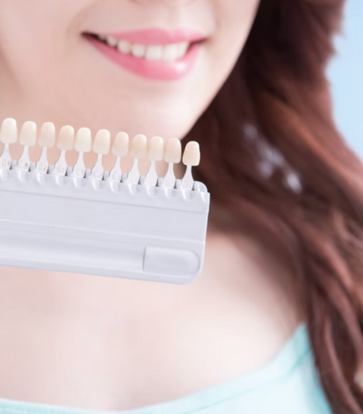 ●歯のホワイトニング 15分×3回