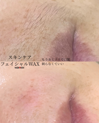 【初回限定】【都度】【回数券お持ちの方】