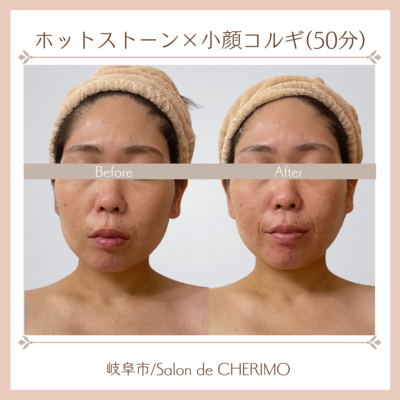 【初回限定】【都度】【回数券お持ちの方】