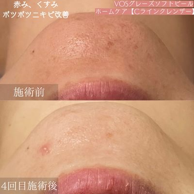 【初回限定】【都度】【回数券お持ちの方】