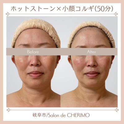 【初回限定】【都度】【回数券お持ちの方】