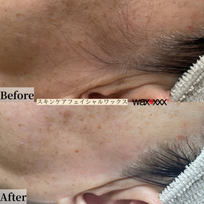 【初回限定】【都度】【回数券お持ちの方】