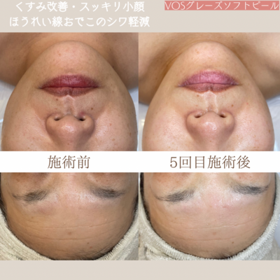 【初回限定】【都度】【回数券お持ちの方】