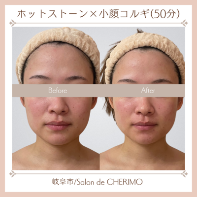 【初回限定】【都度】【回数券お持ちの方】