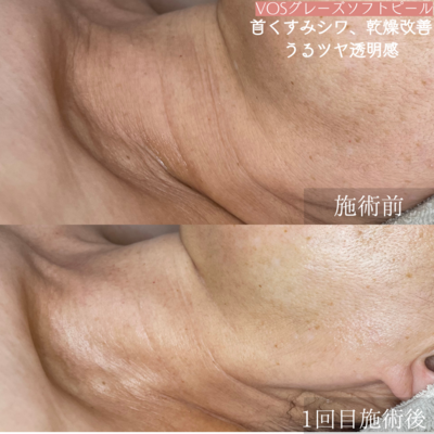 【初回限定】【都度】【回数券お持ちの方】