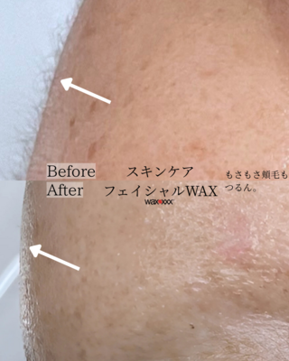 【初回限定】【都度】【回数券お持ちの方】