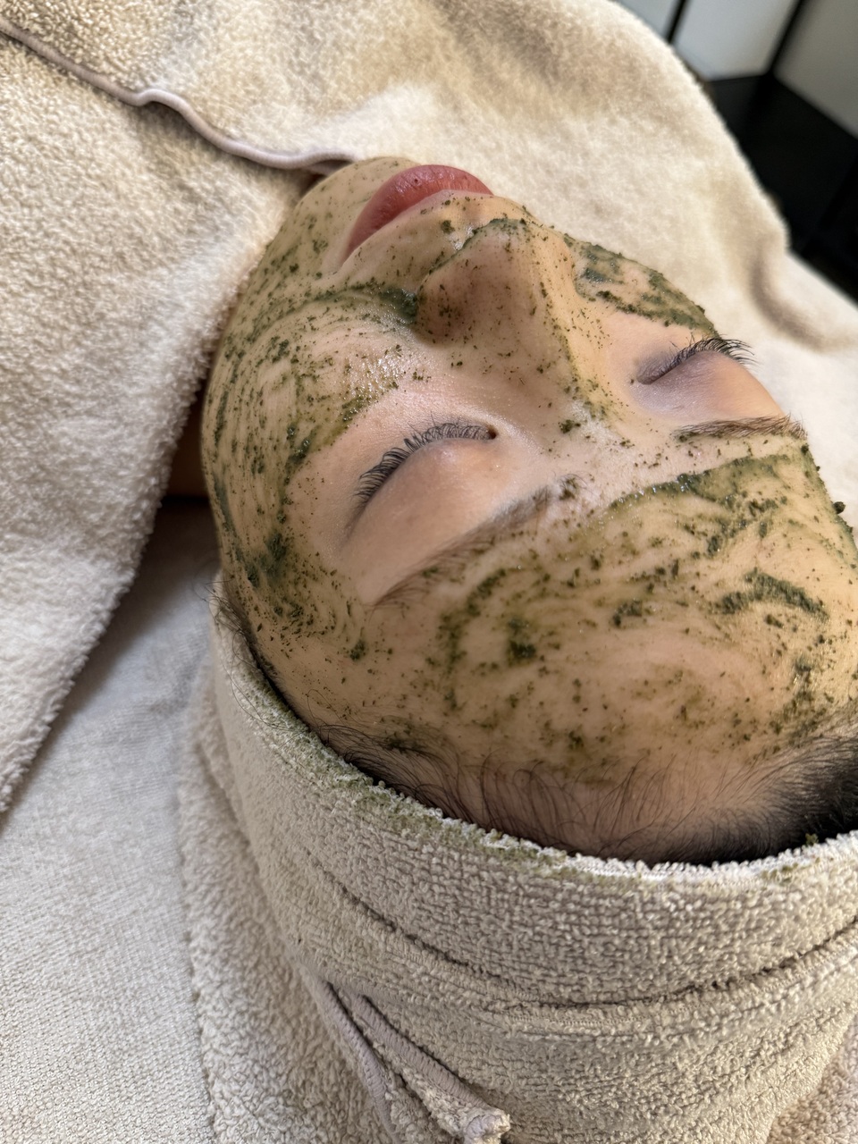 【毛穴・ニキビ特化】剥離なしハーブピーリング