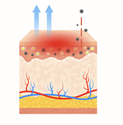 アトピーお話し会