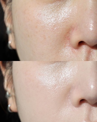 名古屋｜眉メイク・肌管理専門・白髪育毛ヘッドスパ【mire（ミレ）】完全プライベートサロン