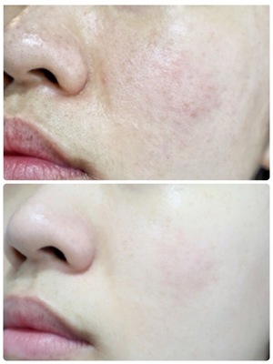 名古屋｜眉メイク・肌管理専門・白髪育毛ヘッドスパ【mire（ミレ）】完全プライベートサロン